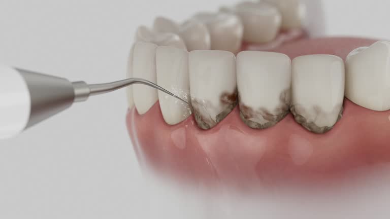 Reliable Dental Implants contractor in Evansburg, PA by Smile Center Dentistry